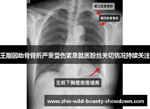 王刚因肋骨骨折严重受伤紧急就医粉丝关切情况持续关注